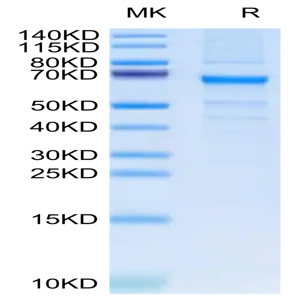 Human FGL2 Protein (FGL-HM212)