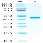 Human FGL2 Protein (FGL-HM612)