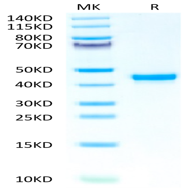 Human FGL2 Protein (FGL-HM612)