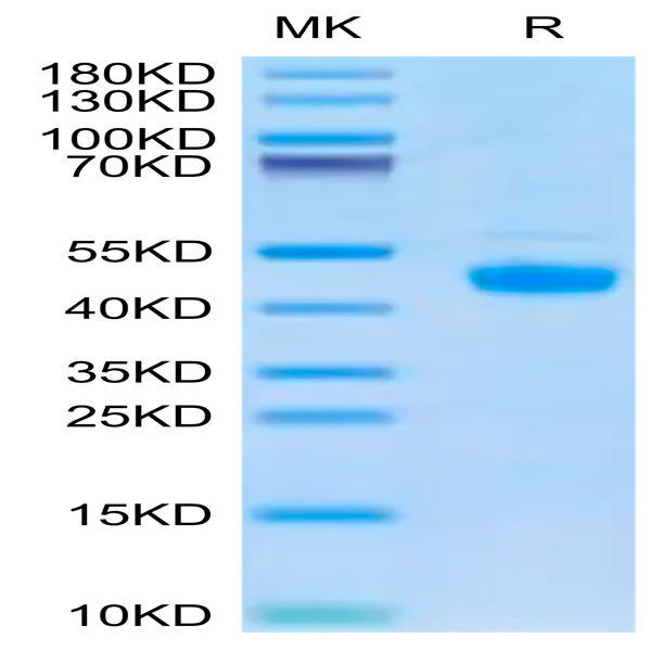 Biotinylated Human FGL2 Protein (FGL-HM612B)