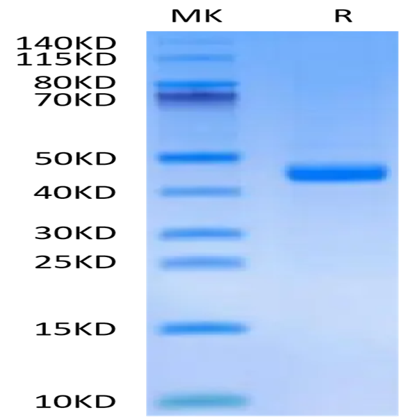 Mouse FGL2 Protein (FGL-MM612)