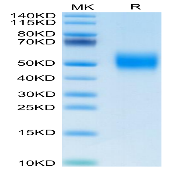 Biotinylated Human FGFR2 beta (IIIb) Protein (FGR-HM4BBB)