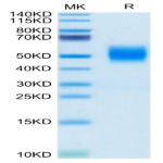 Biotinylated Human FGFR2 beta (IIIc) Protein (FGR-HM4BCB)