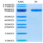 Human Fibronectin (32-602) Protein (FIN-HM102)