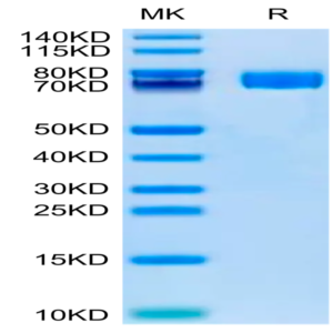 Human Fibronectin (32-602) Protein (FIN-HM102)