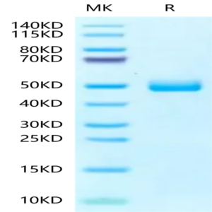 Human Fibronectin (1266-1356) Protein (FIN-HM203)