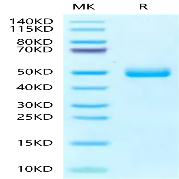 Human Fibronectin (1266-1356) Protein (FIN-HM203)