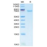FITC-Labeled Human B7-H3CD276 Protein , BH7-HM273F