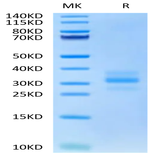 Mouse FLT3 Ligand Protein (FLT-MM13L)