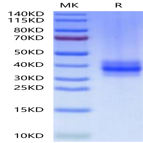 Human FOLR3 Protein (FOL-HM1R3)