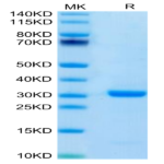 Human FOLR4/Juno Protein (FOL-HM1R4)