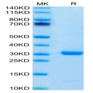 Human FOLR4/Juno Protein (FOL-HM1R4)