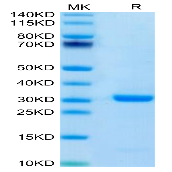 Human FOLR4/Juno Protein (FOL-HM1R4)