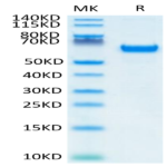 Human FOLR1 Protein (FOL-HM2R2)