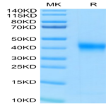 Human FOLR1 Protein (FOL-HM4R1)