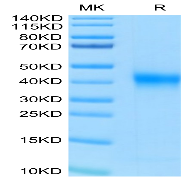 Human FOLR1 Protein (FOL-HM4R1)