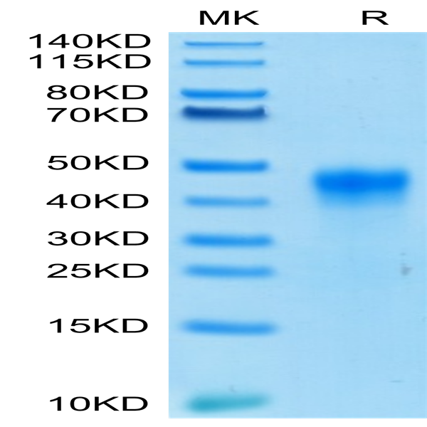 Biotinylated Human FOLR1 Protein (FOL-HM4R1B)