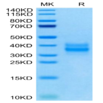 Mouse FOLR1 Protein (FOL-MM1R1)