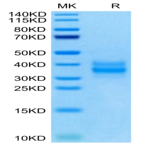 Mouse FOLR1 Protein (FOL-MM1R1)