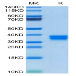 Mouse FOLR2 Protein (FOL-MM1R2)