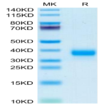 Mouse FOLR4/Juno Protein (FOL-MM1R4)