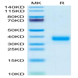 Mouse FOLR4/Juno Protein (FOL-MM1R4)