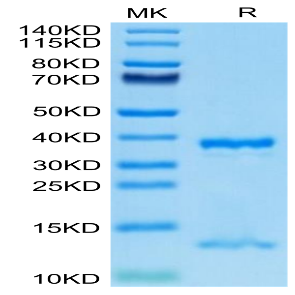 Human FcRn Protein (FRN-HM101)