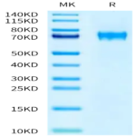 Human FLRT1 Protein (FRT-HM101)