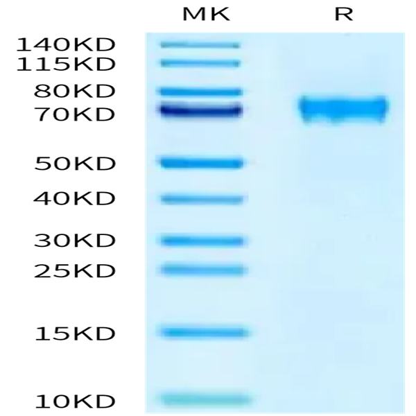 Human FLRT1 Protein (FRT-HM101)