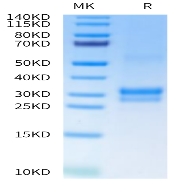 Cynomolgus/Rhesus macaque TNFSF15 Protein (FSF-CM115)