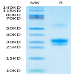 Human TNFSF15 Protein (FSF-HM115)