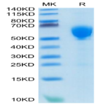 Human GITR Ligand/TNFSF18 Trimer Protein (FSF-HM418)