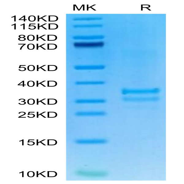 Mouse TNFSF15 Protein (FSF-MM415)