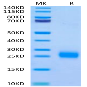 Human FSHB Protein (FSH-HM10B)