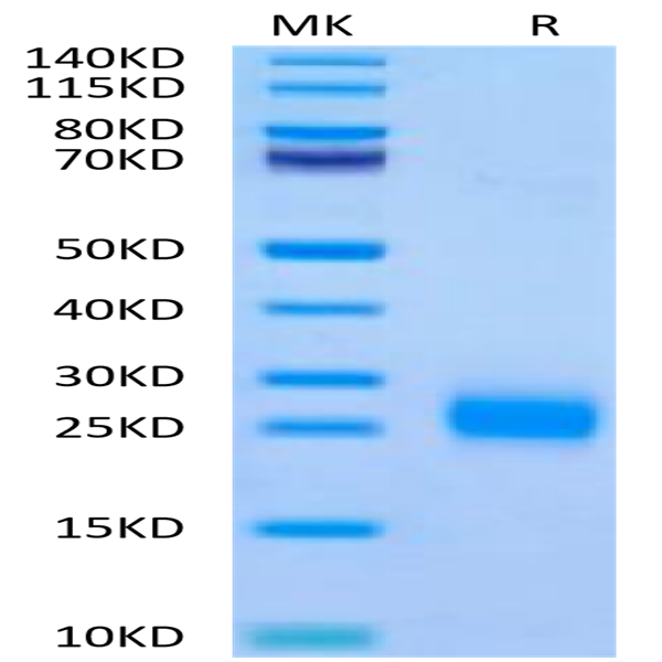 Human FSHB Protein (FSH-HM10B)