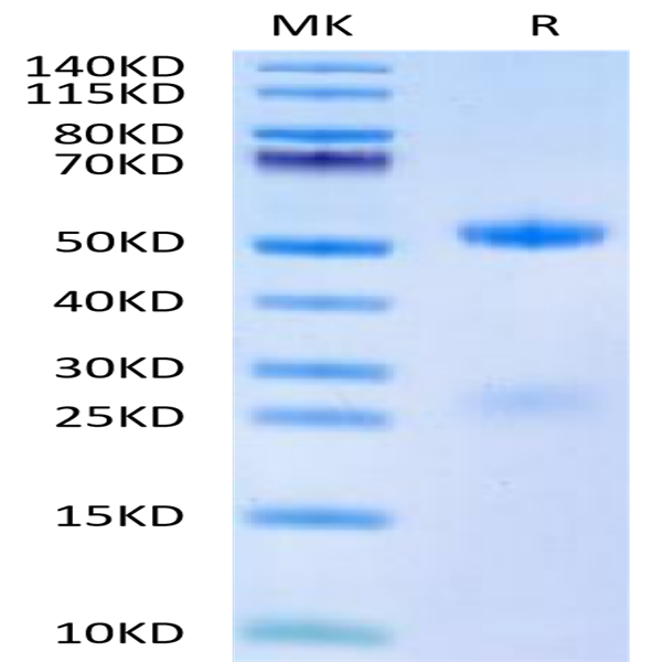 Human FSH alpha&beta Protein (FSH-HM1AB)