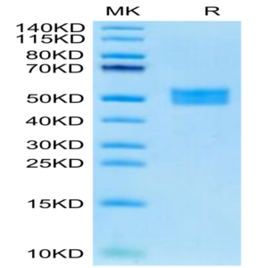 Human FSTL1 Protein (FST-HM1L1)