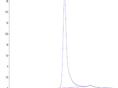 Human Factor XI Protein (FXI-HM101)