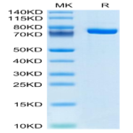 Human Factor XI Protein (FXI-HM101)