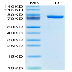 Human Factor XI Protein (FXI-HM101)