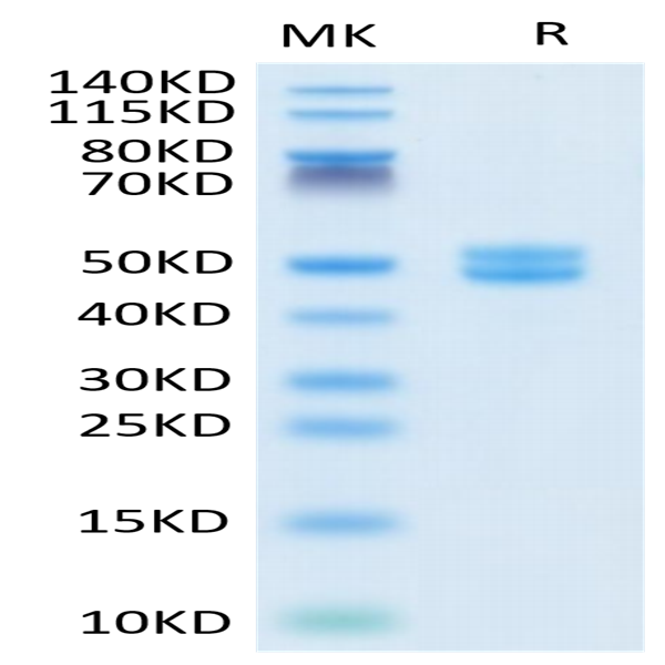 Human Galectin 1 Protein (GAL-HM201)