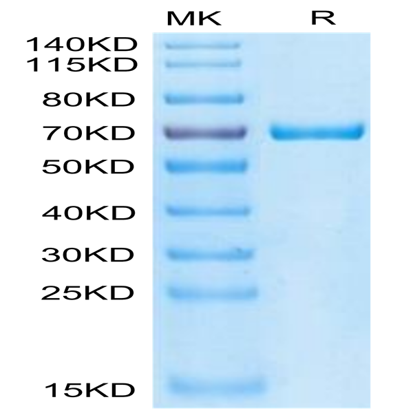 Cynomolgus GAS6 Protein (GAS-CM106)