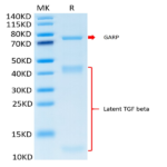 Cynomolgus GARP&Latent TGF beta 1 Complex Protein (GAT-CM401)