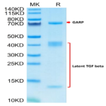 Human GARP (Y137H) &Latent TGF Beta 1 Complex Protein (GAT-HM102)