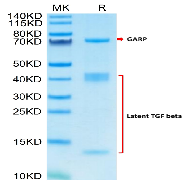 Human GARP (Y137H) &Latent TGF Beta 1 Complex Protein (GAT-HM102)
