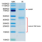 Human GARP (S138G) &Latent TGF Beta 1 Complex Protein (GAT-HM103)