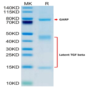 Human GARP (S138G) &Latent TGF Beta 1 Complex Protein (GAT-HM103)