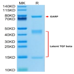 Human GARP (G139N) &Latent TGF Beta 1 Complex Protein (GAT-HM104)