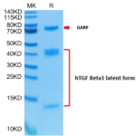 Human GARP&Latent TGF Beta 1 Complex Protein (GAT-HM401)