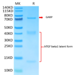 Biotinylated Human GARP&Latent TGF beta 1 Complex Protein (GAT-HM401B)